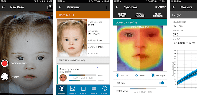 Face2Gene - Face Recognition app